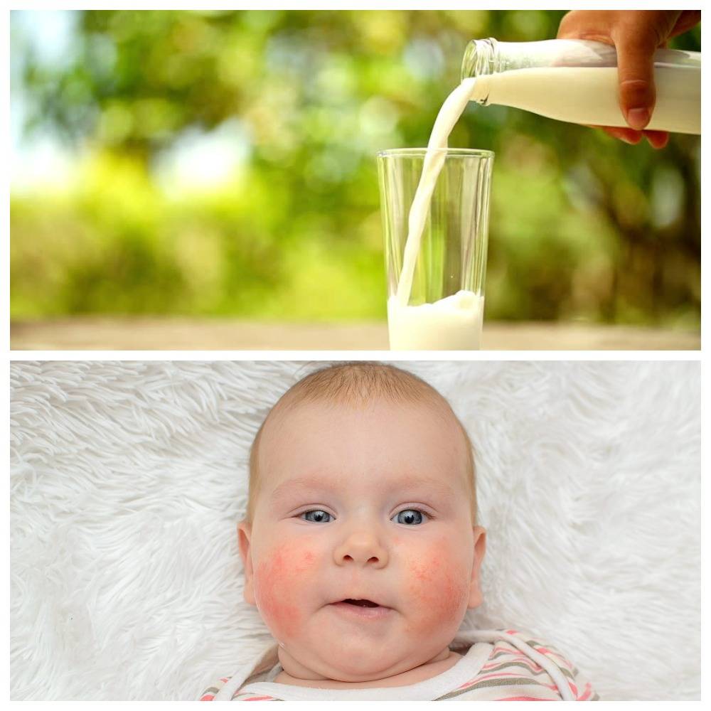 Непереносимость молока: как распознать и чем питаться