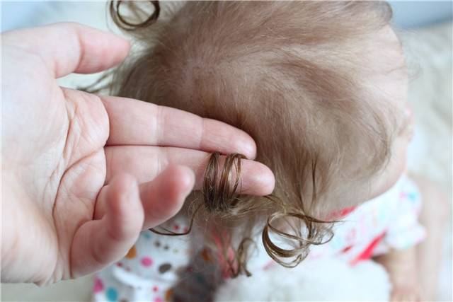 Почему сильно выпадают волосы после родов и что делать: как укрепить волосы после родов
