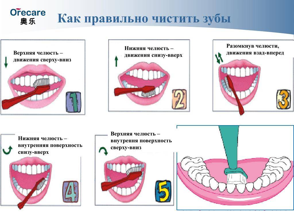 Плюсы чистки зубов. Схема правильной чистки зубов. Алгоритм правильной чистки зубов. Какпровельно чистить зубы. КСК праивльно чистить щубы.