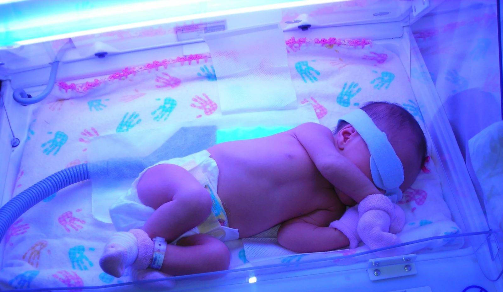 Желтуха у новорожденных: лечение в домашних условиях