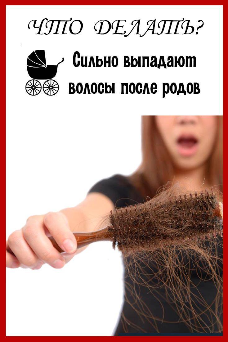 Выпадение волос (алопеция, облысение) у мужчин и женщин: причины, лечение – напоправку