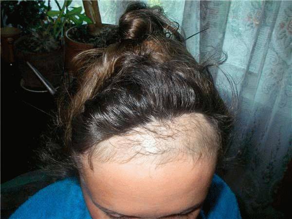 Почему у человека волосы растут только на голове