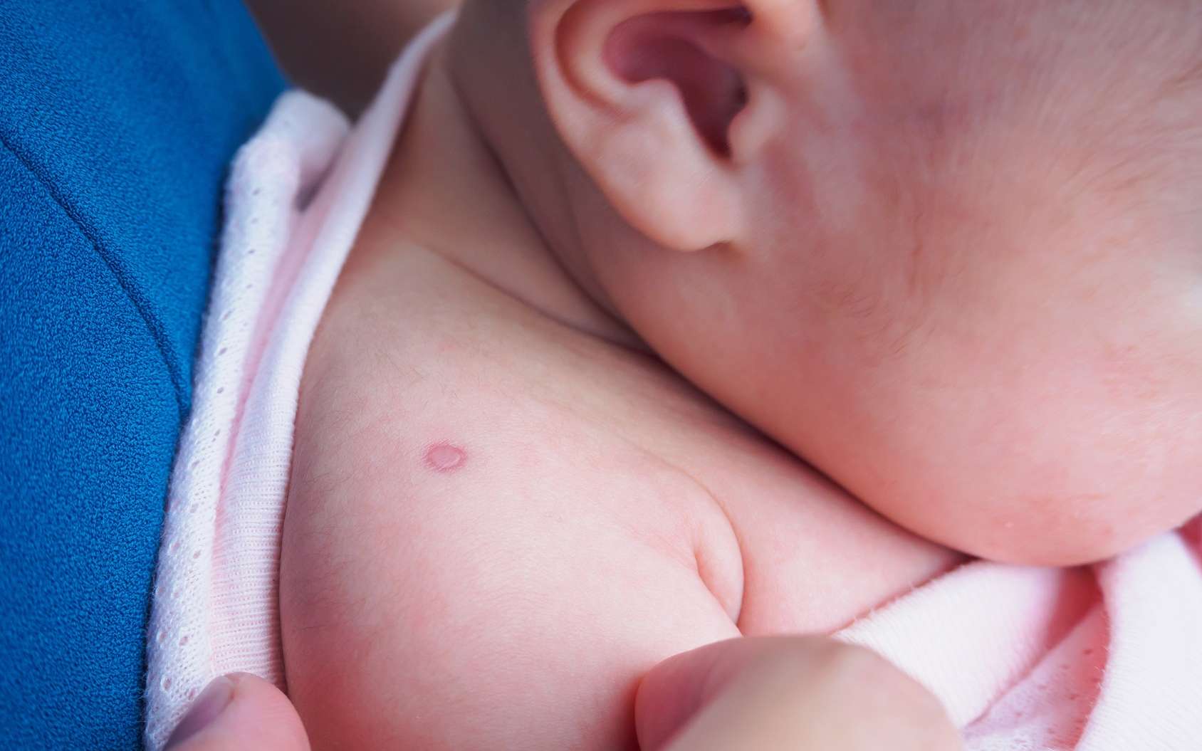 График прививок детям до года - плановые прививки для грудничков - причины, диагностика и лечение