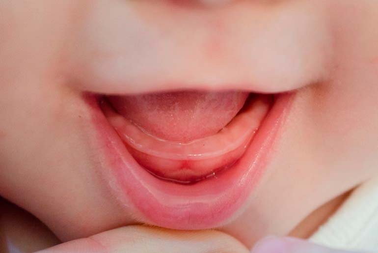Почему крошатся зубы у ребенка: разрушение молочных зубов у детей от 1 года до 2 лет