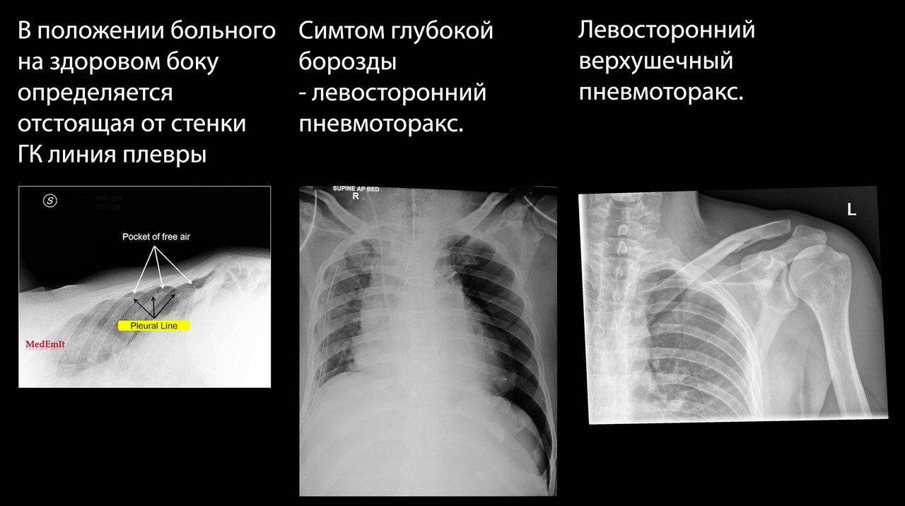 Рентген копчика, подготовка к рентгену копчика в клинике цэлт в москве