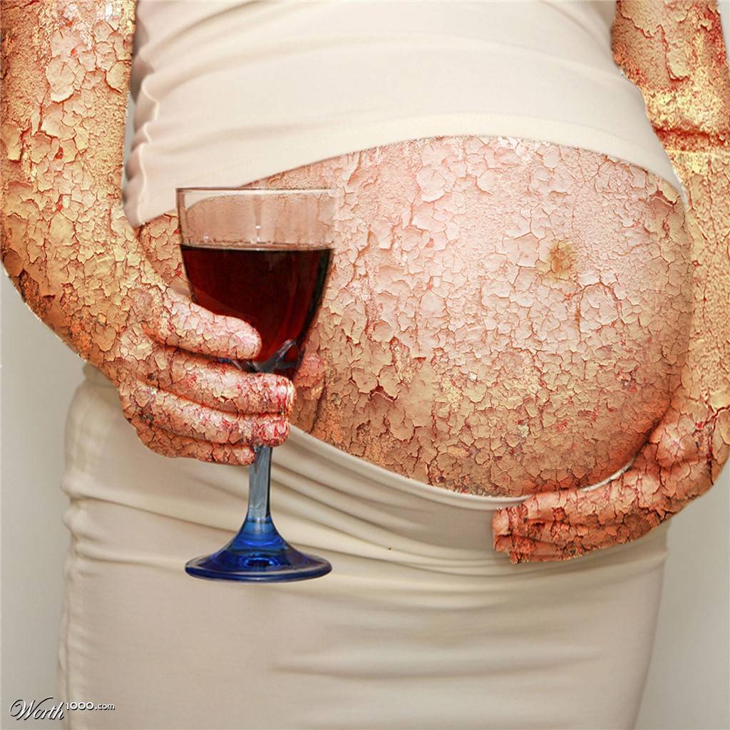 Пить после беременной. Алкоголь и беременность. Алкоголизм беременных.