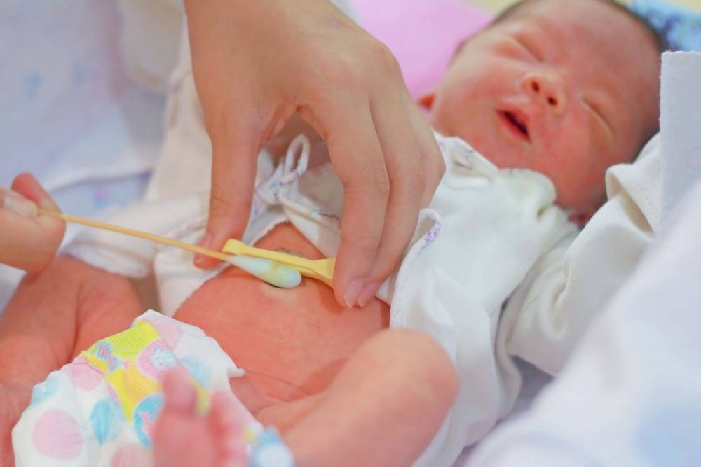 Как обрабатывать пупок новорожденного с прищепкой и без нее