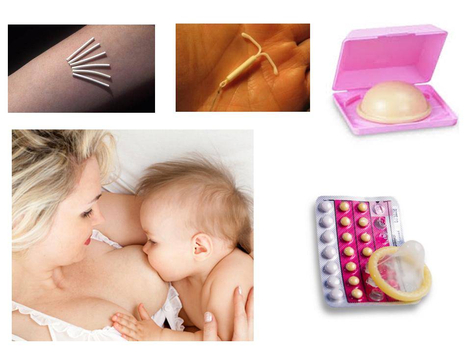 Методы контрацепции при лактации
