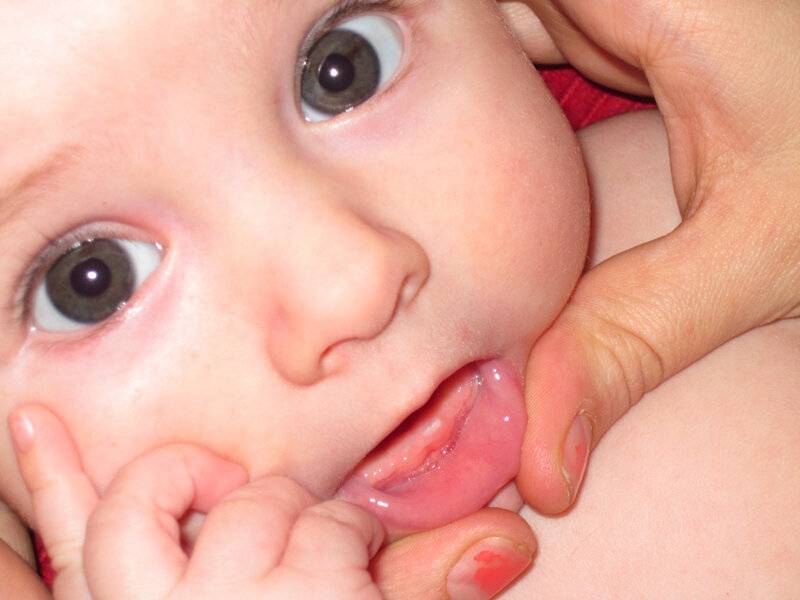 Что делать, когда у ребенка лезут первые клыки