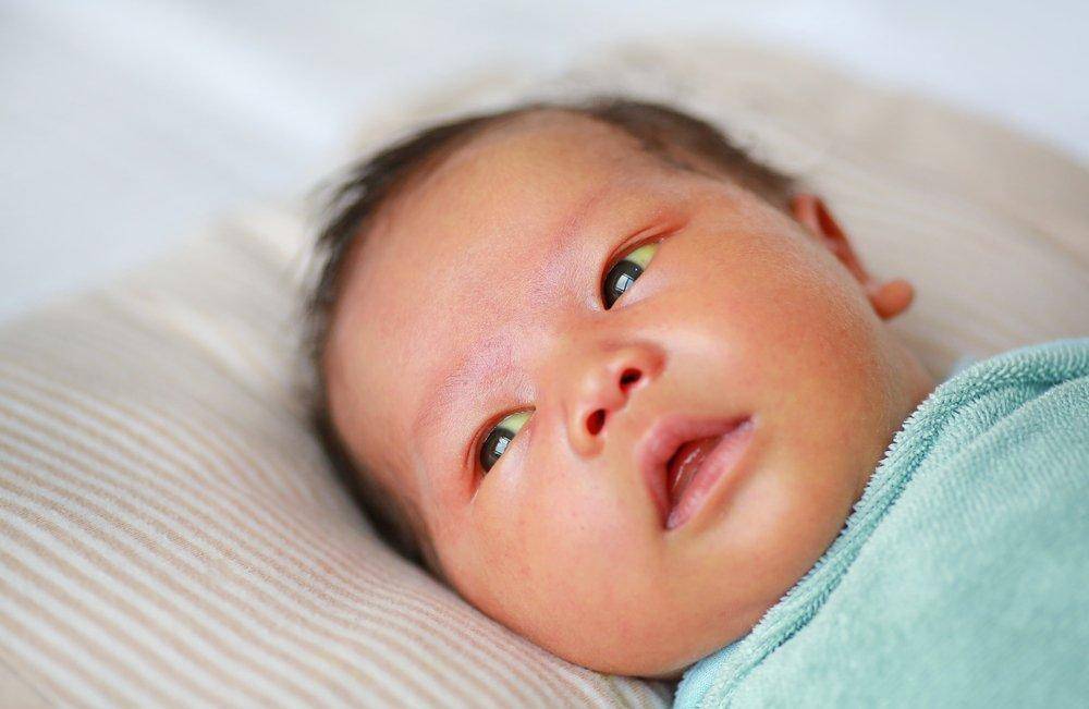 Как лечится желтуха у новорожденных в родильном доме?