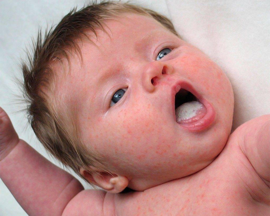 Текут слюни у 2 месячного ребенка, причины повышенного слюноотделения у грудничка