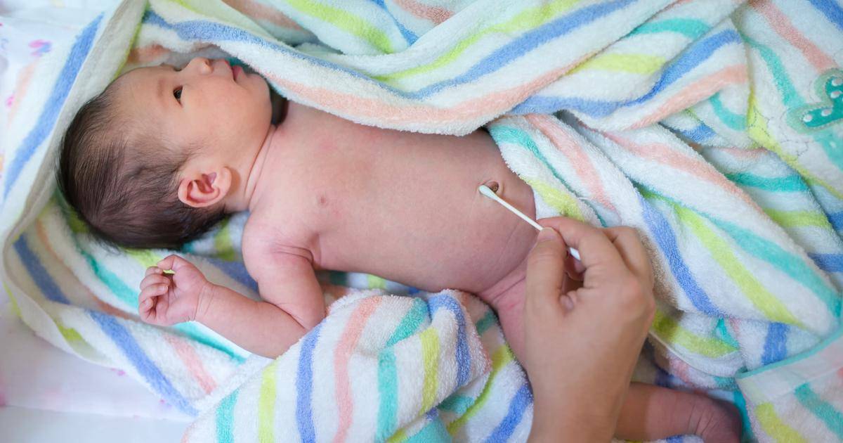 Как обрабатывать пупок новорожденного. как он заживает?