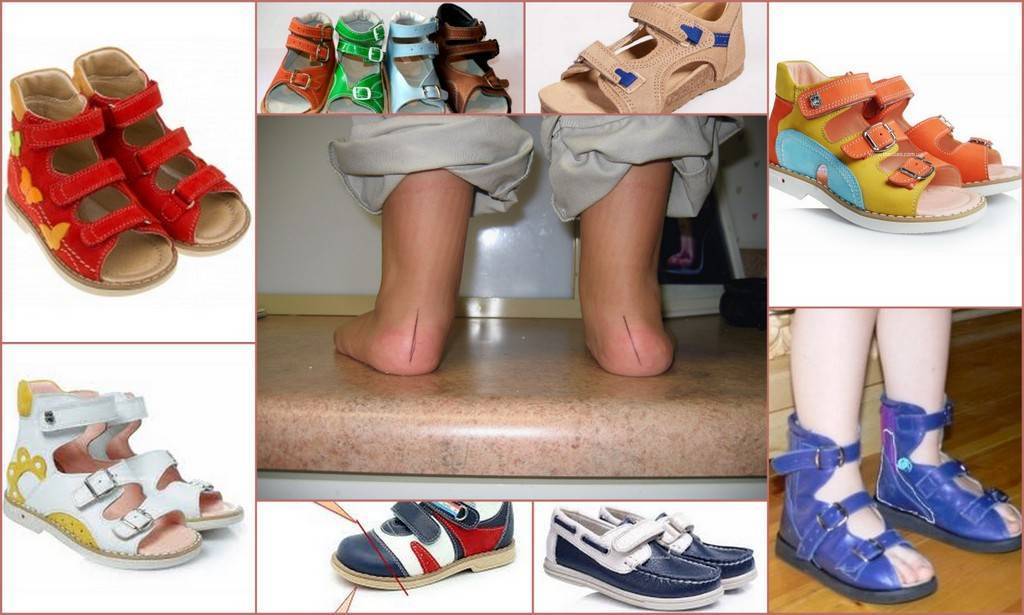 Нужна ли ребенку дома обувь?