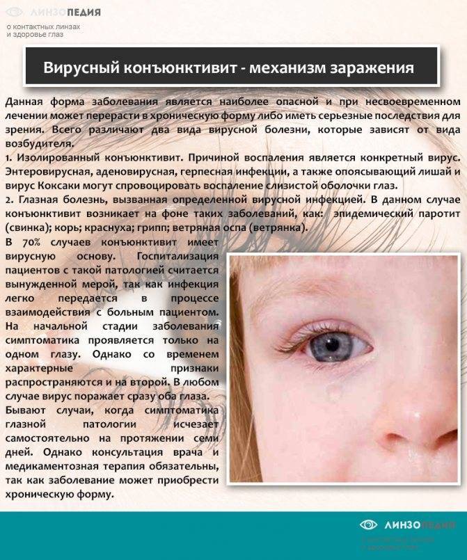 Аденовирус – детская инфекция: типичные симптомы, лечение