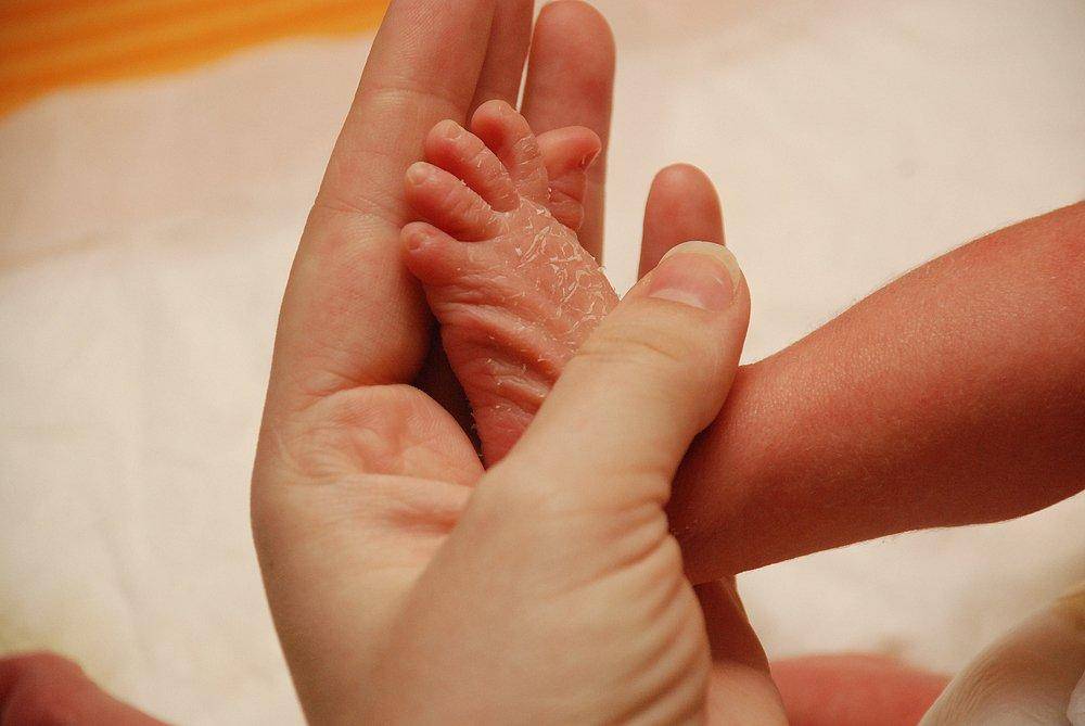 Что делать при сухости кожи у новорожденного