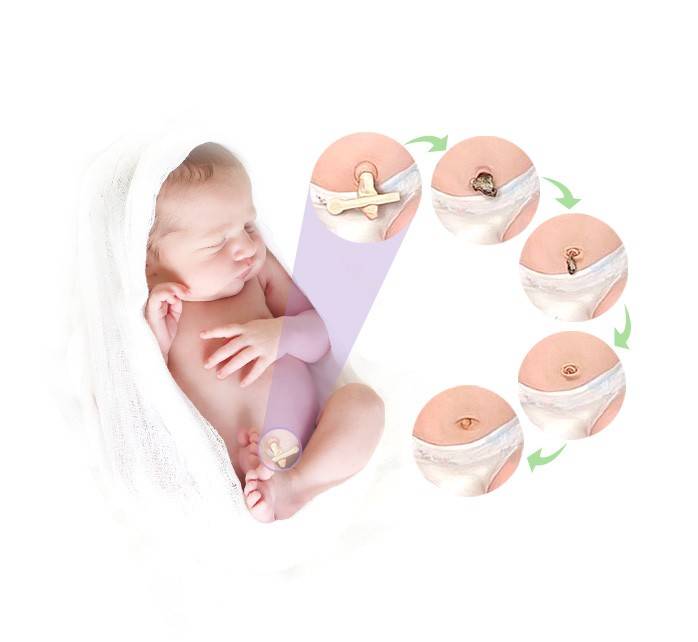 Как обрабатывать пупок новорожденного: современные рекомендации